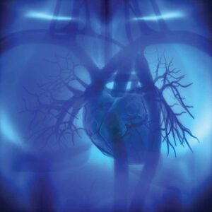 Contrast Echocardiographic Imaging in Clinical Trials | WCG